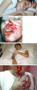 Child victims of the barbaric crackdown in Bahrain